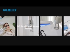 Fraktionierte CO2-Laser Hautverjüngung Hautverengung